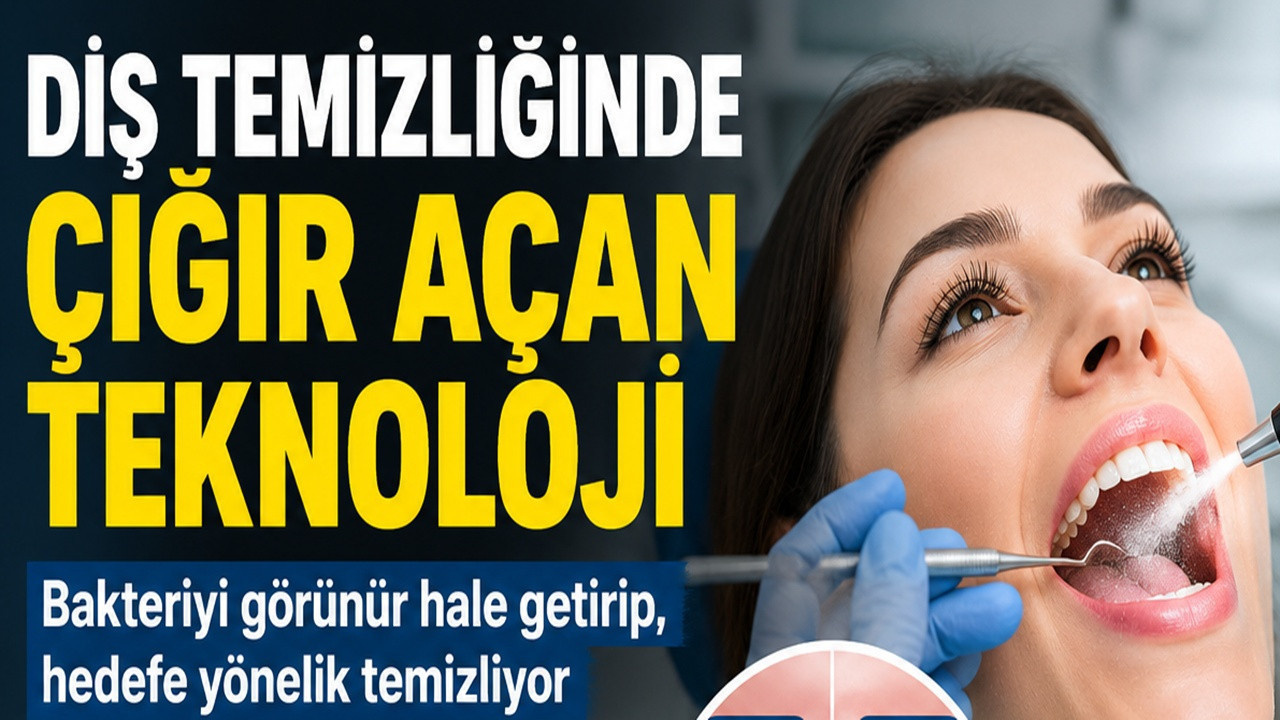 DiÅ temizliÄinde yeni teknoloji: Hava, su ve ince tozla çalıÅıyor