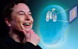 Neuralink çipi takılan bir hasta iyileşti!