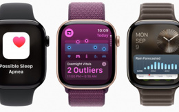 Apple Watch Series 11’in getireceği yenilikler ve muhtemel fiyatı