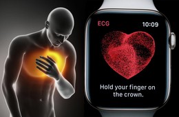 Apple Watch hayat kurtarmaya devam ediyor!
