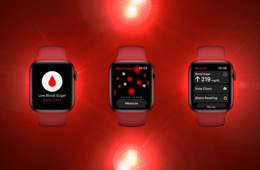Apple Watch beklenmedik bir teknolojiyle donatılacak!