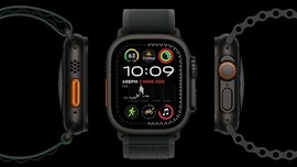 Apple Watch bir kez daha hayat kurtardı, kalp krizini önledi