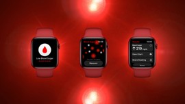 Apple Watch beklenmedik bir teknolojiyle donatılacak!