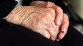 Alzheimer mucizesi: Yeni ilaç hastalığın seyrini 4 yıl yavaşlatıyor