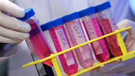 Bilim İnsanları: Uzun Covid, Parkinson ve Felç benzeri etkilere yol açıyor