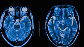 Yapay zeka ile yüz analizi: depresyon belirtileri erken tespit edilecek