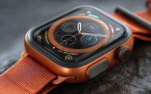 Yeni Apple Watch'larda ciddi sorun!