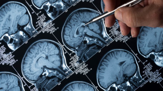 Kan testleriyle Alzheimer’ın ilk belirtileri tespit edilebilir