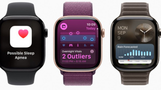 Apple Watch Series 11’in getireceği yenilikler ve muhtemel fiyatı