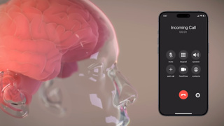 Neuralink beyin implantı düşünceleri metne çevirecek