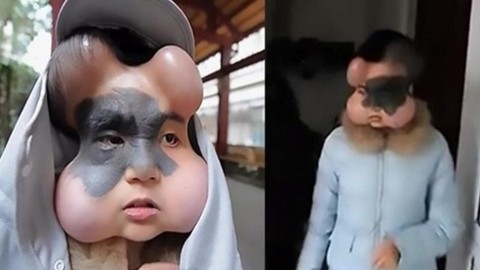 İlk defa göreceğiniz ilginç hastalıklar