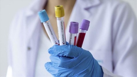 Beklenen oldu! Aşı olmayanlar toplu taşımayı kullanamayacak