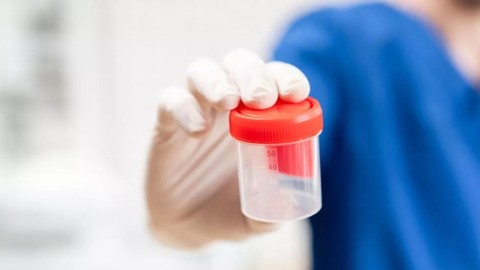 Sperm testi nedir? Sperm testi nasıl yapılır?