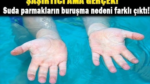 Suda ellerin buruşma nedeni farklı çıktı!