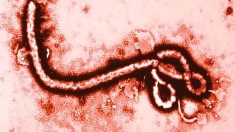 Ebola virüsünü 15 dakikada teşhis eden test geliştirildi!