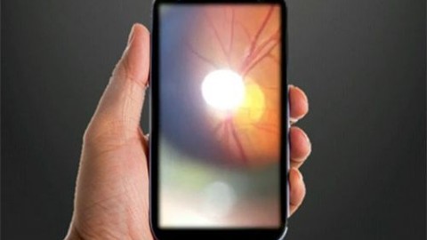 Akıllı telefonlar göz hastalığınızı bilecek