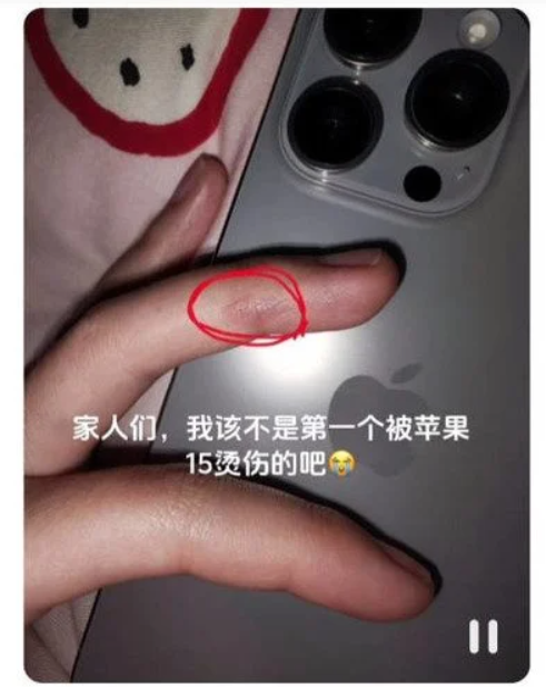 iPhone 15 Pro sahipleri çok pişman! Artık vücutları zarar görmeye başladı! - Resim : 1