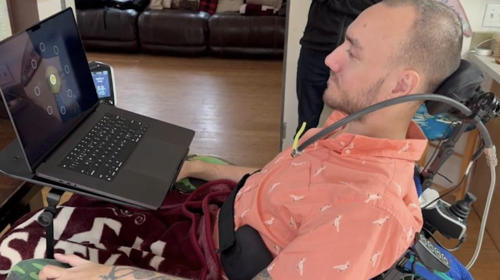 Neuralink beyin implantı düşünceleri metne çevirecek - Resim : 1