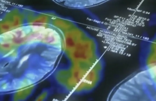 Bu beslenme düzeni beyni genç tutuyor! - Resim : 1