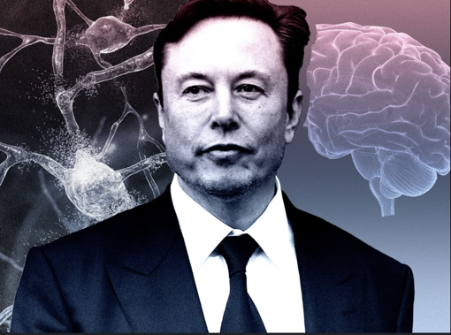 Neuralink İngiltere’ye göz dikti: Elon Musk’ın beyinlere çip takmak istiyor - Resim : 1
