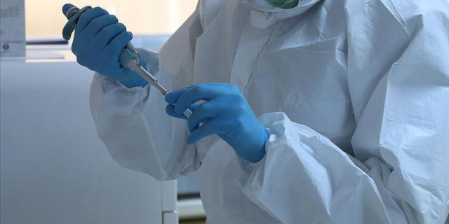 Koronavirüs ile mücadelede yeni dönem: Türk ışını tedavisi! - Resim : 1