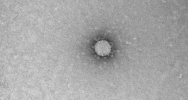 Koronavirüs mikroskop ile ilk kez görüntülendi! - Resim : 1