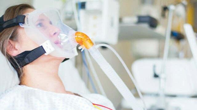 Yerli solunum cihazı seri üretime geçiyor! - Resim : 1