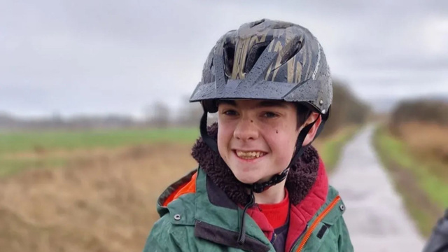 Epilepsi hastası bir çocuğun beynine yerleştirilen implant, mucize yarattı - Resim : 1