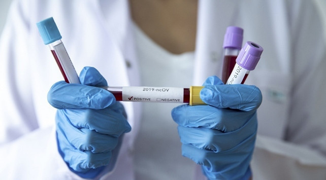 Türkiye'de geliştirilen koronavirüs aşısı insanlarda denenmeye hazır! - Resim : 1