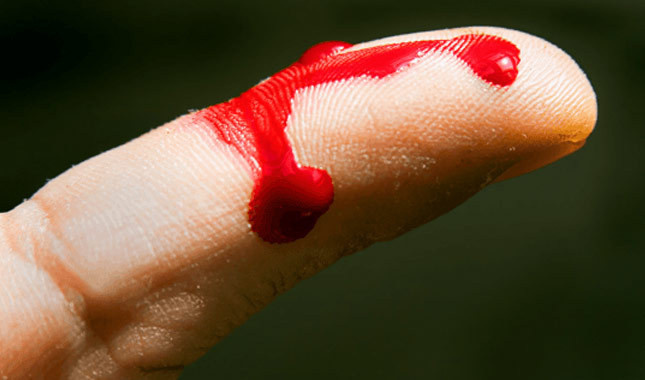 Bilim insanları kanı dönüştürecek teknik geliştirdi! - Resim : 1