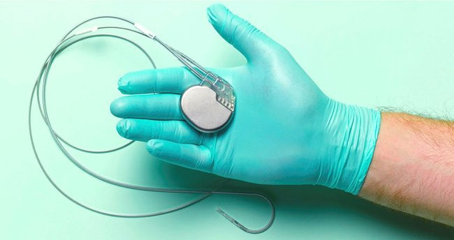 iPhone 12 öldürüyor! Şaka değil! - Resim : 1