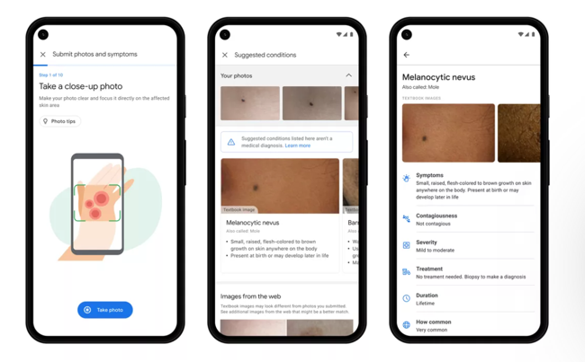 Google sağlık sektöründe çığır açıyor! - Resim : 1