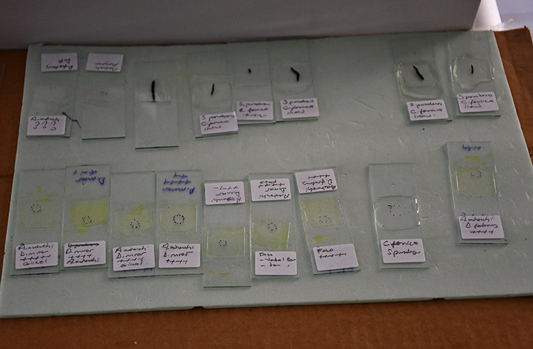 Türk bilim insanları yeni bir parazit türü keşfetti - Resim : 1