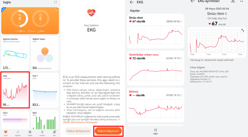 Rönesansın güzelliği bileğinizde: HUAWEI WATCH GT 3 Pro Seramik - Resim : 7
