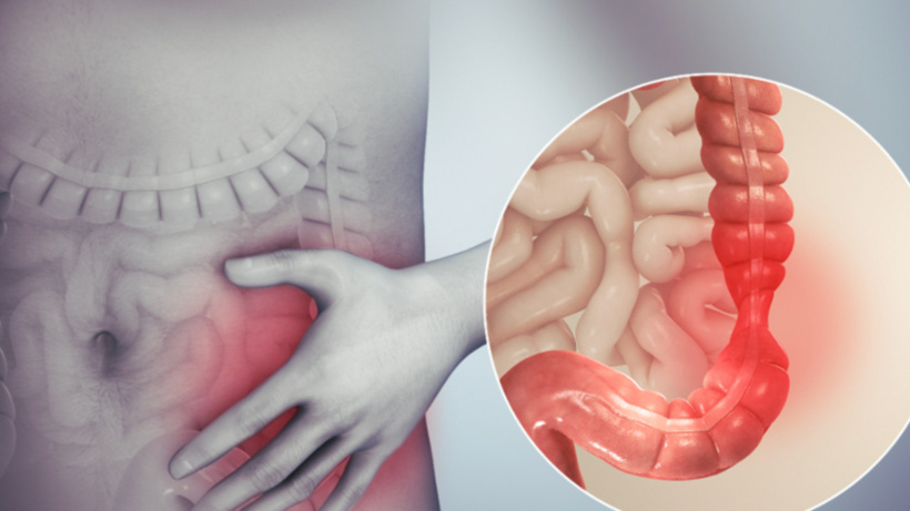 Bağırsak sorunlarına çözüm olan ek gıda!