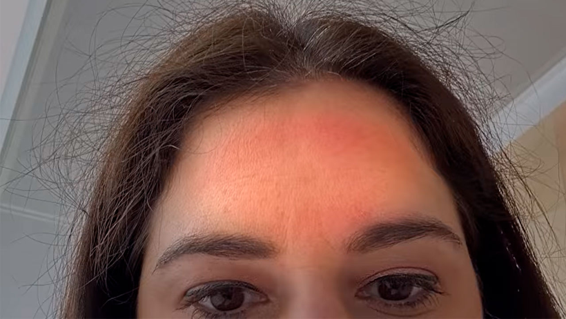 Apple Vision Pro yüzde istenmeyen kızarıklıklara neden oluyor! - Resim : 1