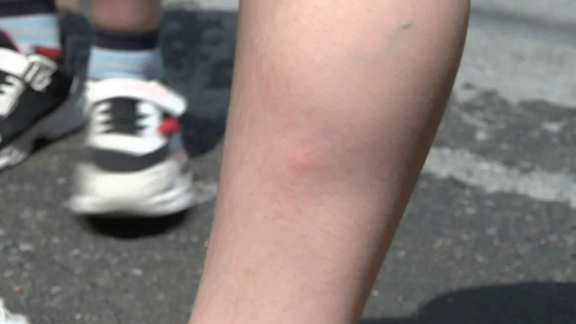 İstanbul'da "sivri sinek" tedirginliği! Sosyal medyadan yardım çağrısı - Resim : 4