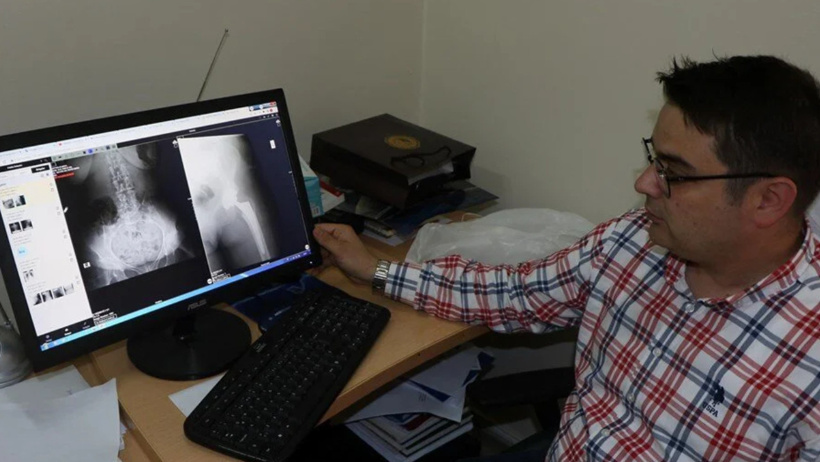 Covid-19 sonrası o hastalıkta vakalar arttı! - Resim : 1