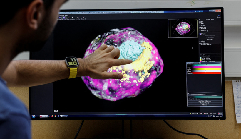 Bilim kurgu gerçek oluyor! Japonya, insan embriyosu üretecek