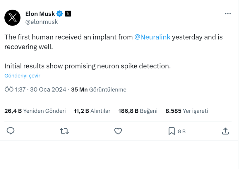 Elon Musk açıkladı! İnsana çip taktık! - Resim : 1