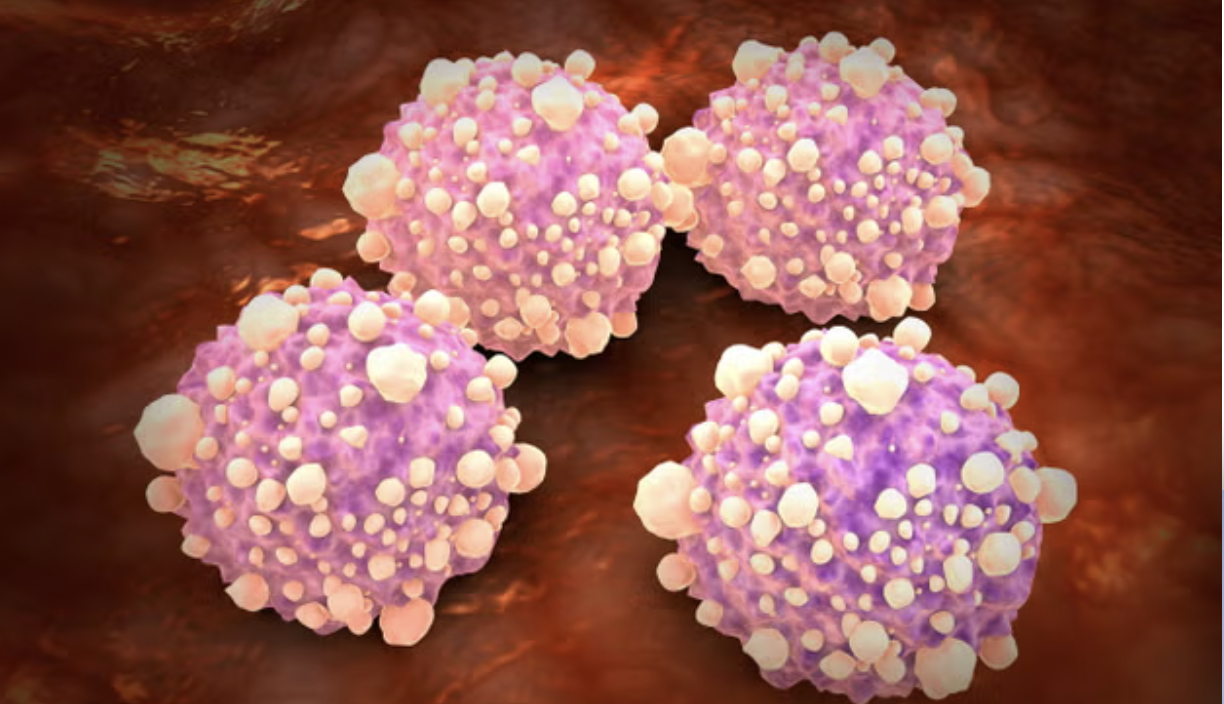 Yeni Kan testi bu hastalıklar için umut olabilir! - Resim : 1